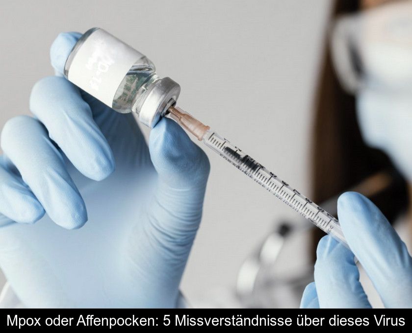 Mpox Oder Affenpocken: 5 Missverständnisse über Dieses Virus