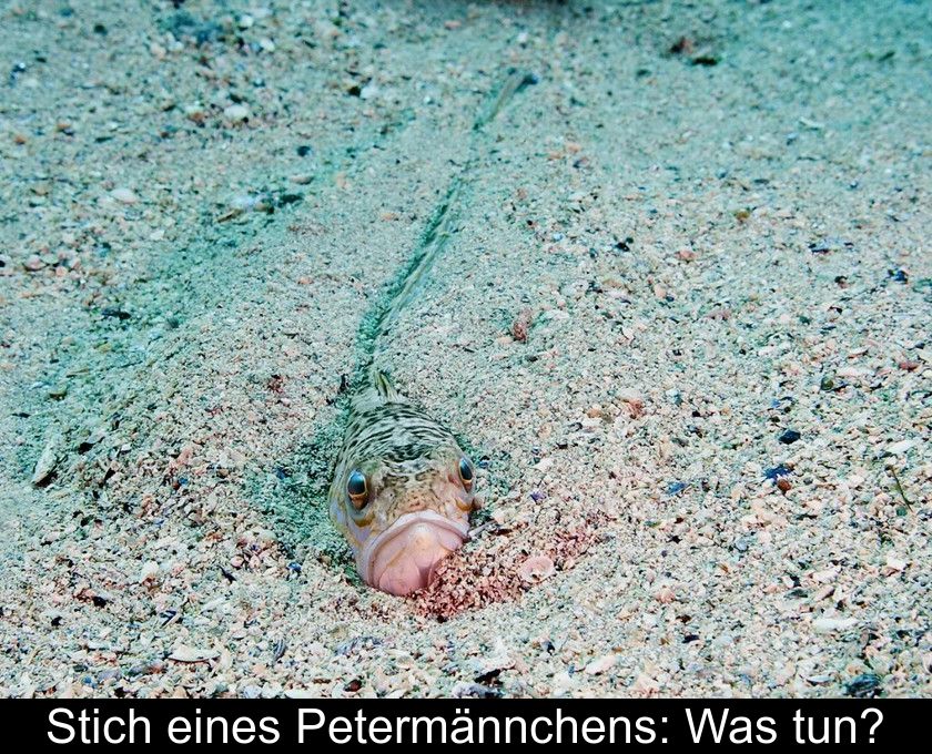 Stich Eines Petermännchens: Was Tun?